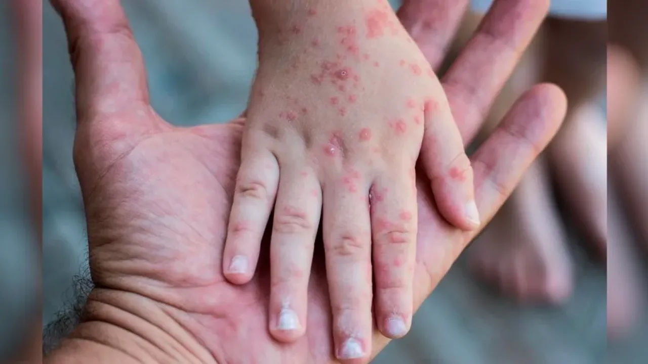 Фото до новини