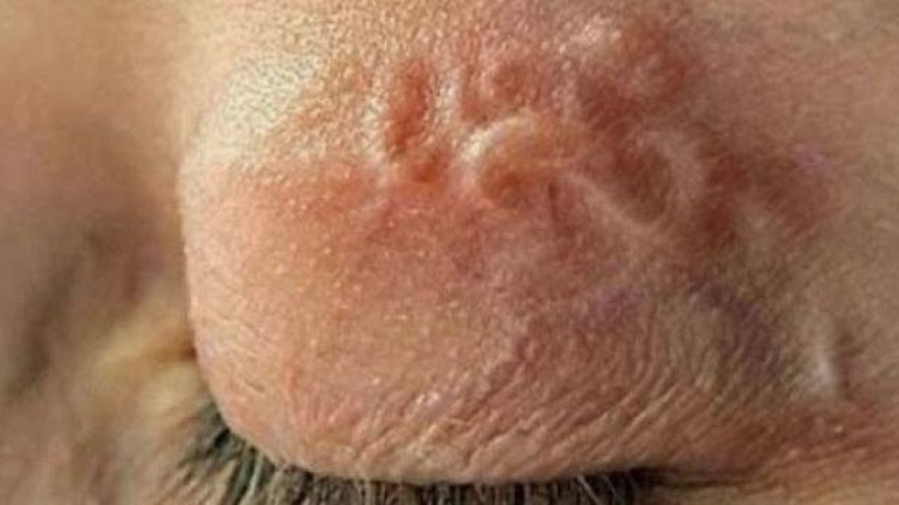 Фото до новини