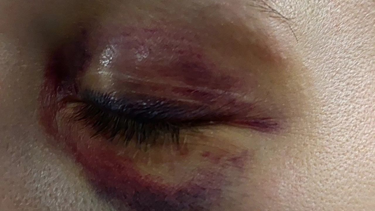 Фото до новини